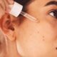 Skin Tag Removal at Home: What Works and What to Avoid