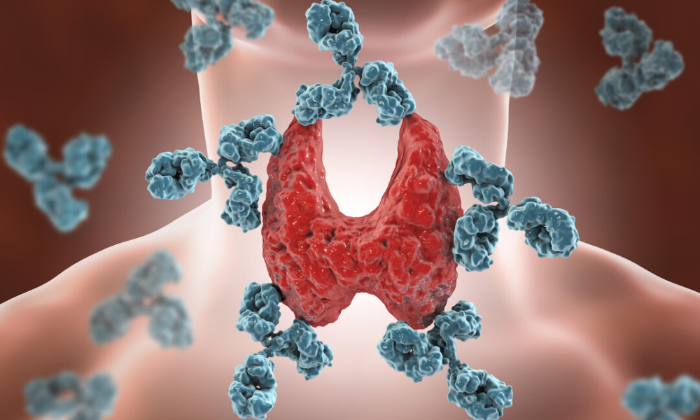 Autoimmune